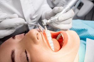 Dental Hygiene Session In Southampton