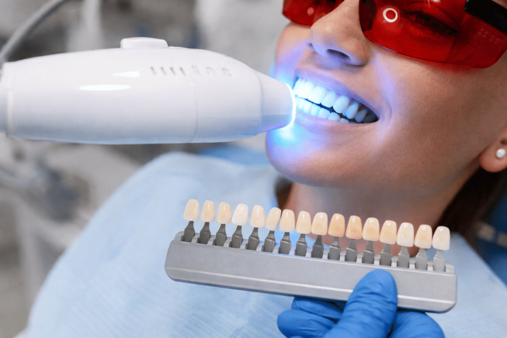 Teeth Whitening