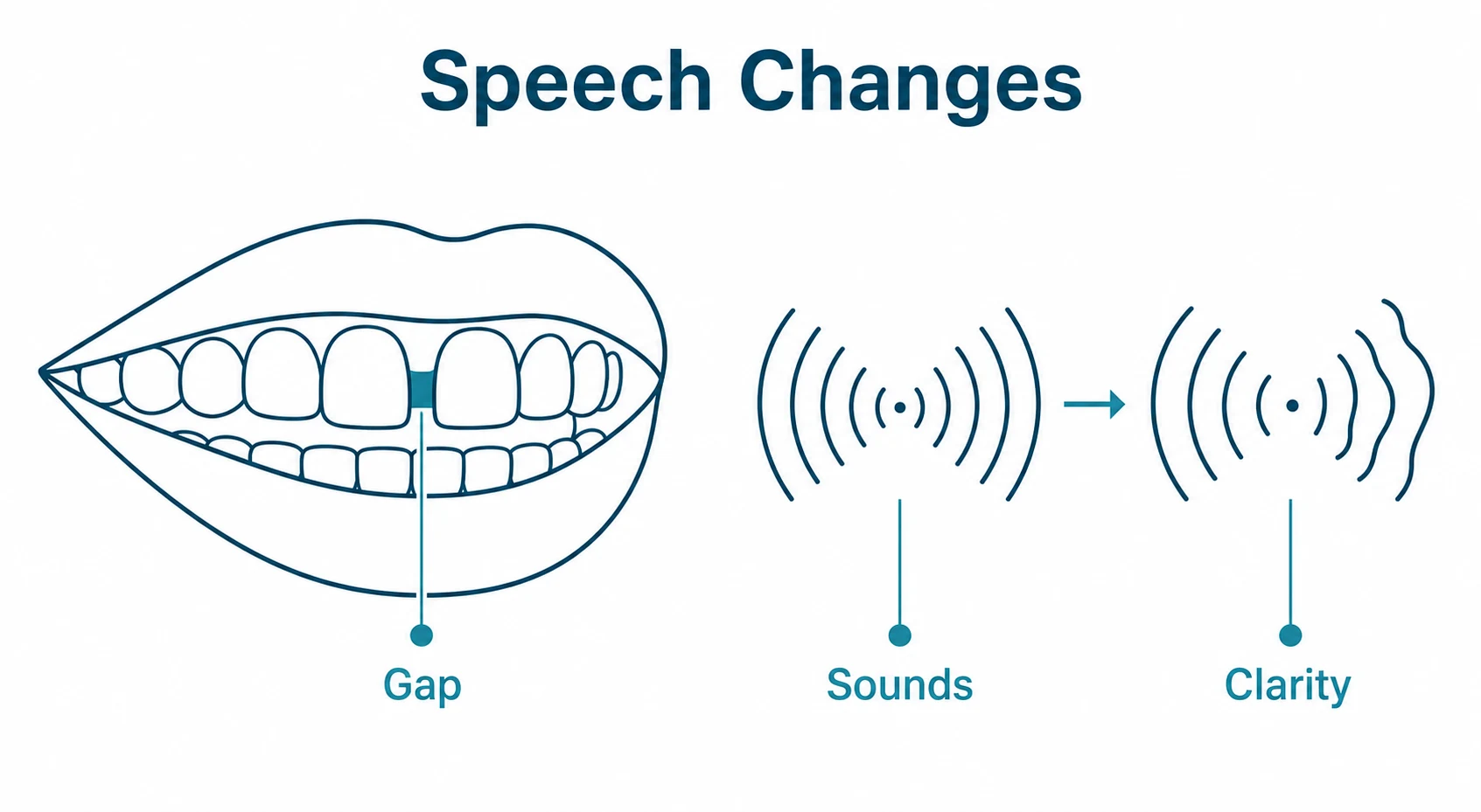 Graphic showing a tooth gap affecting speech clarity.