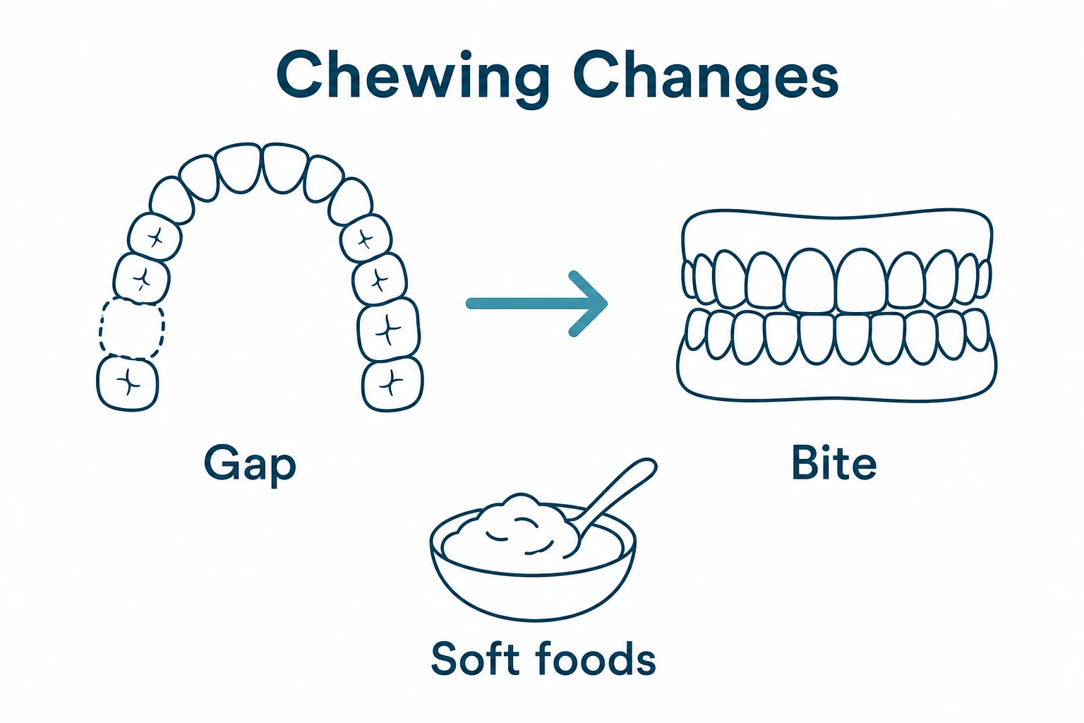 Graphic showing how a tooth gap can affect chewing and food choices.