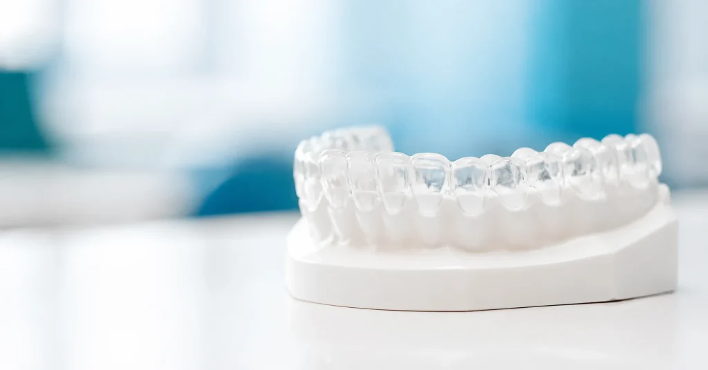 Clear aligner on a clean dental model in a modern dental clinic