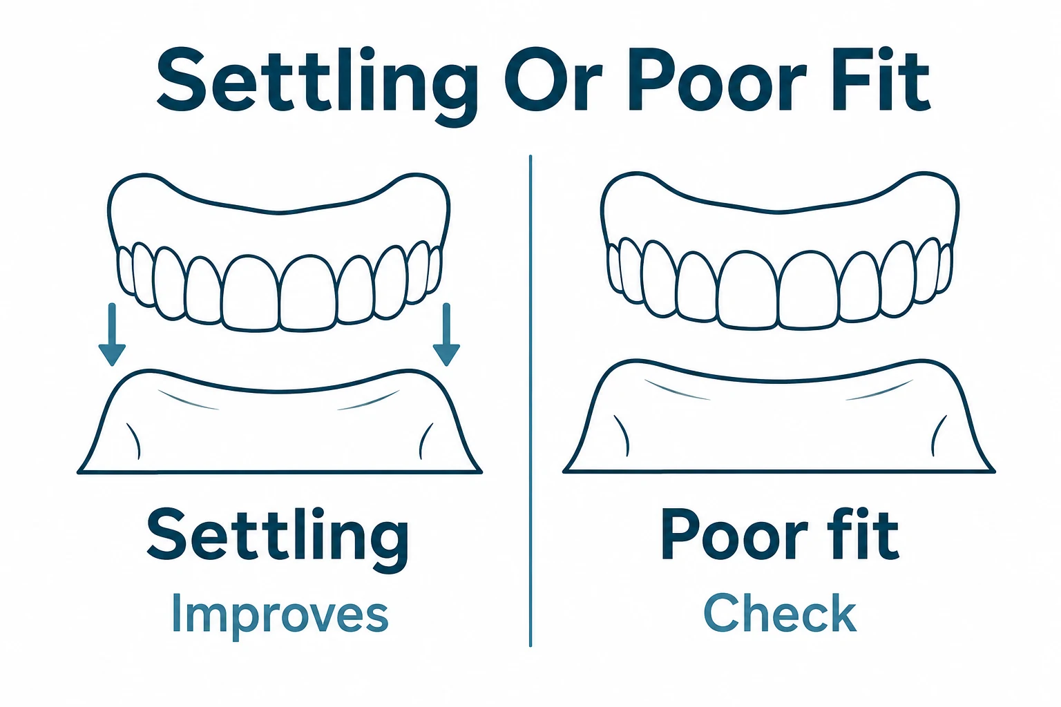Graphic comparing normal denture settling with a poor fit